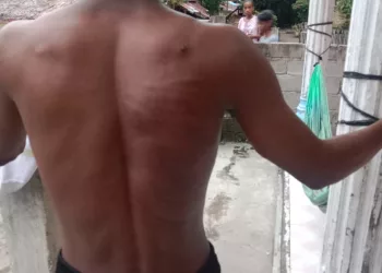 Sejumlah Oknum TNI AD BKO Aniaya Warga Luhu Sampai Babak Belur