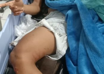 Prajurit Bekangdam XVI/Pattimura Tewas Lakalantas di Jalan Rijali, Penabrak Pelajar SMA yang Diduga Mabuk